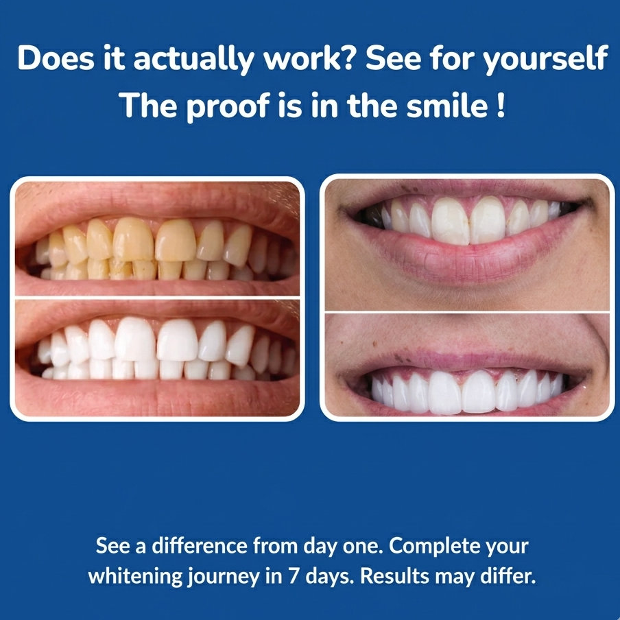 Instant teeth whitening for a brighter smile