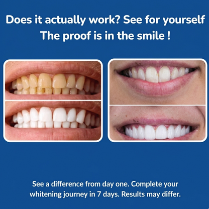 Instant teeth whitening for a brighter smile